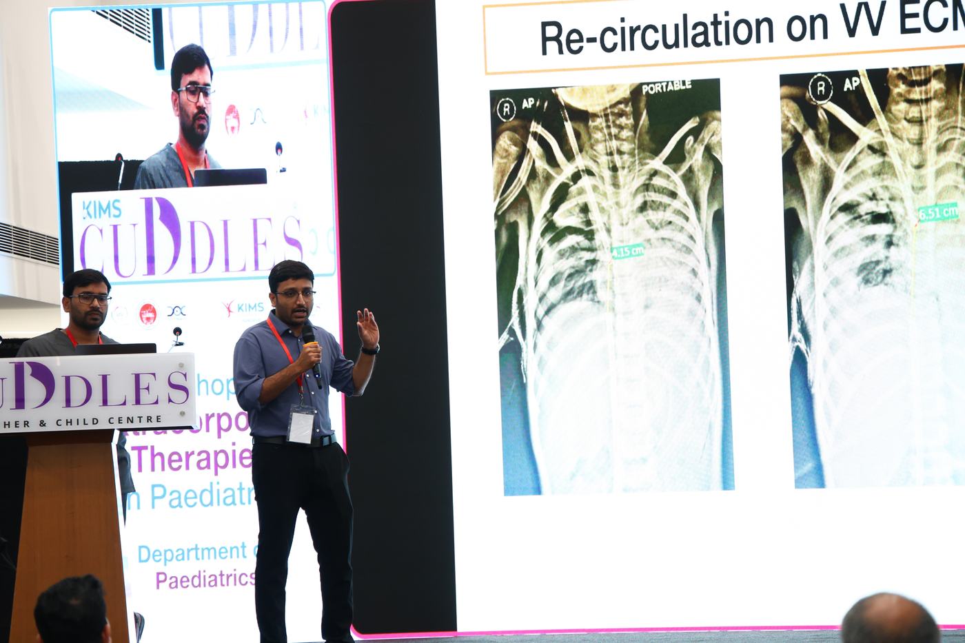 Dr. Suchit Jogu presenting on VV ECMO re-circulation at a pediatric critical care workshop, KIMS Cuddles Kompally